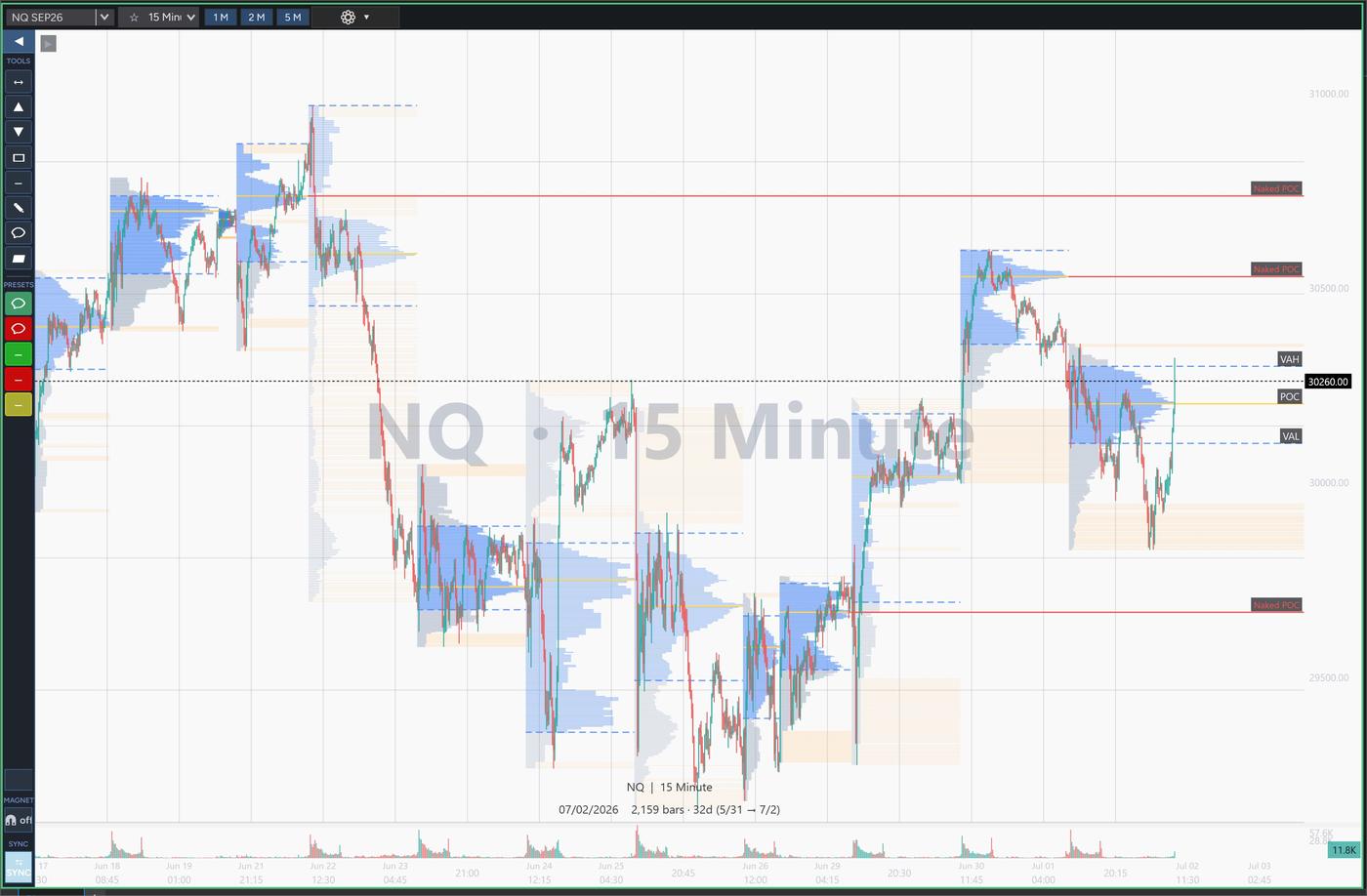 CustomChart Volume Profile session projection with prior-session profiles and untested (naked) POC levels projected forward as horizontal lines until price trades through them